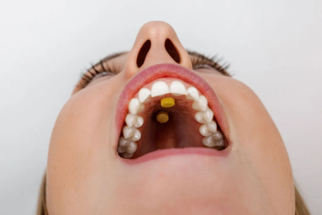 Logicana-Myospots-tongue exercise-optimal breathing-tongue elevation-tongue posture-nasal breathing