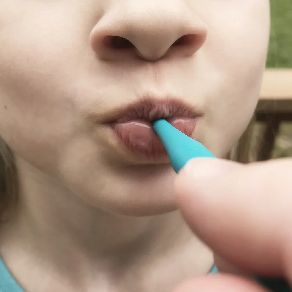 Logicana-lip closure-lip strength-feeding development-saliva control