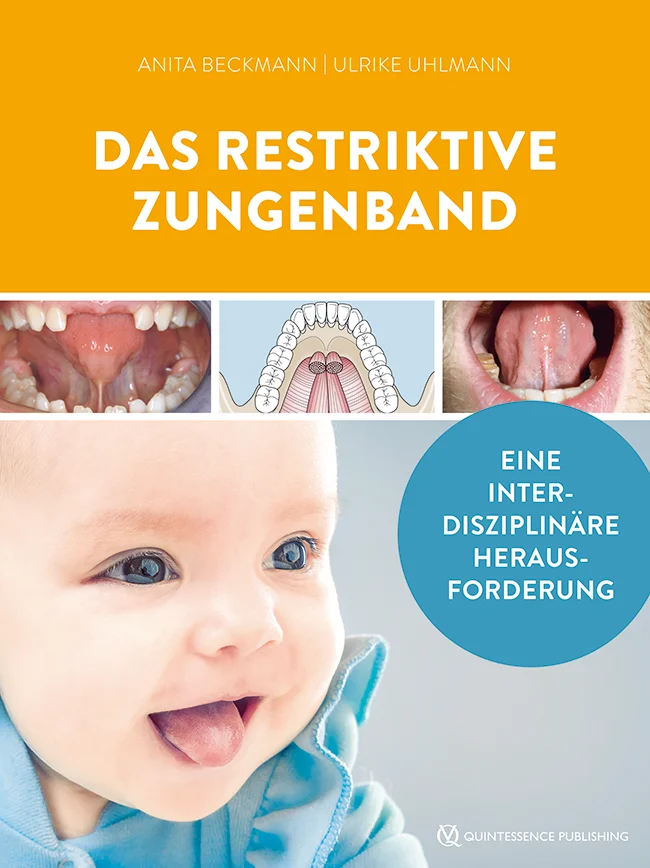 myofunktionelle Therapie-Stillschwierigkeiten-Zahn und Kieferfehlstellungen-Sprachentwicklung-sensmotorischen Entwicklung-Probleme bei der Nahrungsaufnahme
