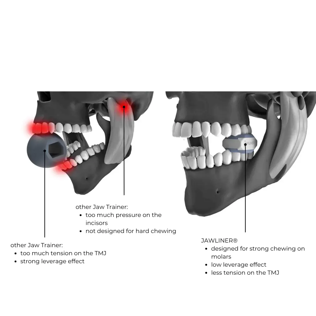 jawline training-jawlines trainieren-jawline trainer-jawliner-jaw trainer-jawline vorher nachher-kiefer training-kiefer trainieren-jawline exerciser