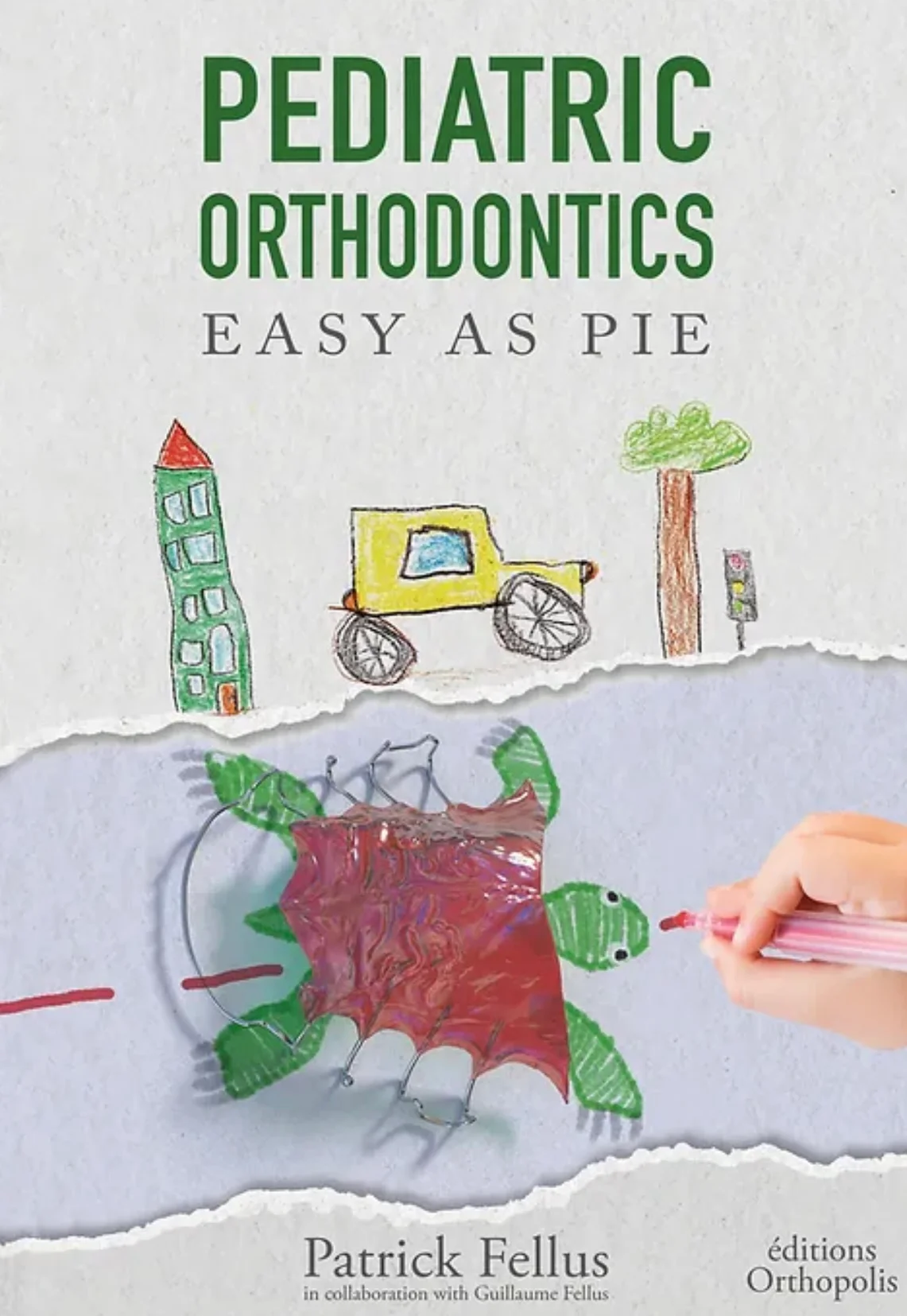 Pediatric orthodontics-Jaw misalignments-Child-friendly orthodontics