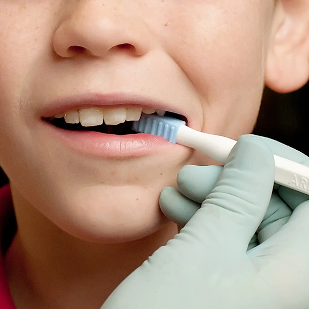 ARK Probe in uso per stimolare labbra lingua guance palato e gengive con tocchi sfioramenti e lieve pressione